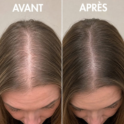 CEPARIA – Anti-Chute & Densité Capillaire