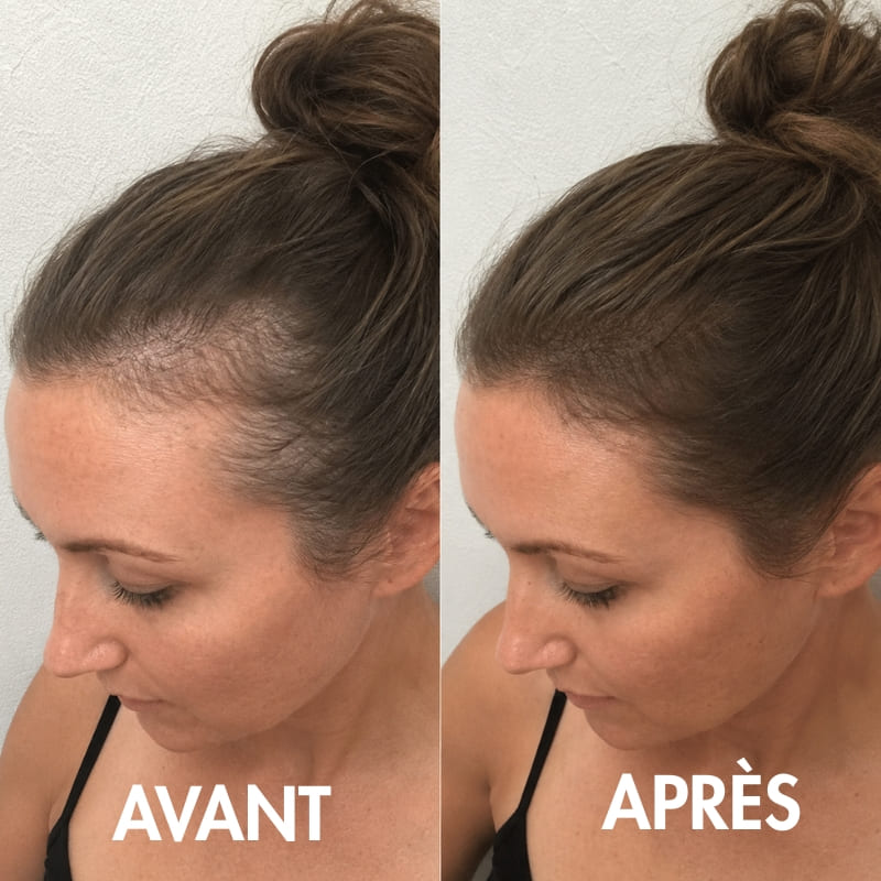 CEPARIA – Anti-Chute & Densité Capillaire